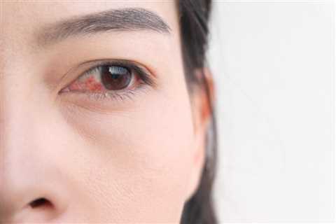 Symptoms of Pink Eye Mold Exposure - Pink Mold